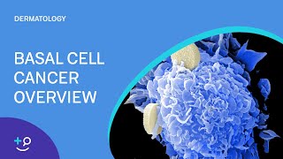 Basal Cell Cancer Overview [Dermatology]