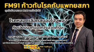 โรคหลอดเลือดสมองโป่งพอง ภัยเงียบมากับอาการปวดศีรษะ : FM91 ก้าวทันโรคกับแพทยสภา : 30 พฤษภาคม 2566