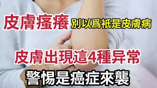 身體發癢，別以爲衹是皮膚病！醫生提醒：出現這4種瘙癢，警惕是癌症來襲了，別大意！