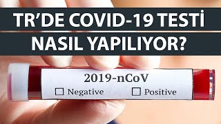 Hepimizin Merak Ettiği Soru: Türkiye'de Corona Virüsü Testi Nasıl Yapılıyor? Paralı mı? Nerede?