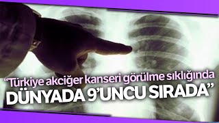 Akciğer ve Mesane Kanserinde Ortak Sebep ‘Sigara’