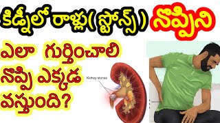 How to detect kidney stones pain | Kidney stones symptoms and signs in telugu | Kidney stone pain