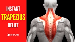How to Fix Upper Trapezius Pain FOR GOOD