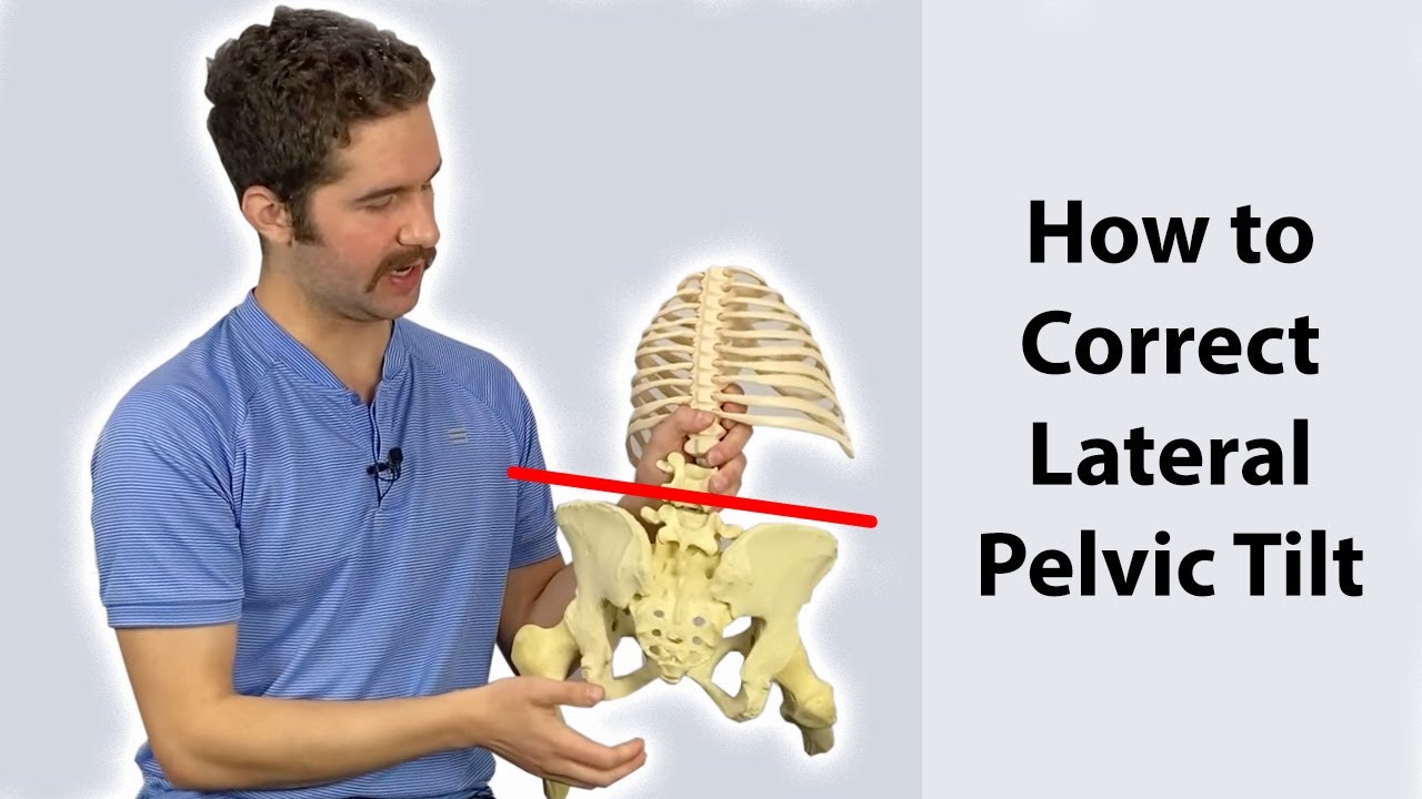 Lateral Pelvic Tilt Correction