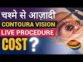 Process & Cost Of Contoura Vision Laser Eye Surgery