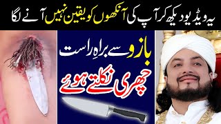A knife sticks out of his arm | Kala Jadu Ka Ilaj | Haq Khatteb Hussain