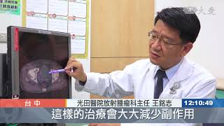 攝護腺癌初期無症狀 50歲後定期檢查