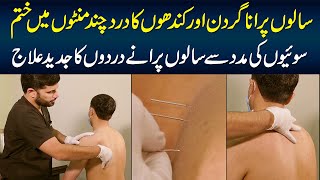 How To Get Rid of Neck and Shoulder Pain in Minutes? Dry Needling Technique by a Physiotherapist