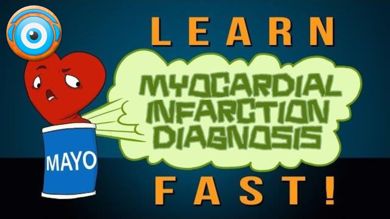 Myocardial Infarction Diagnosis: Learn It Fast Remember It Longer (Step ...