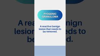 Pyogenic Granuloma - A reactive benign lesion that needs to be removed. #pathology #SurgicalMaster