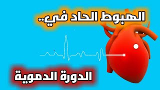 انتشار هبوط الدورة الدموية والموت المفاجئ