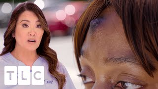 Dr. Lee Removes A Nipple From This Patient’s Forehead! I Dr. Pimple Popper: Pop Ups