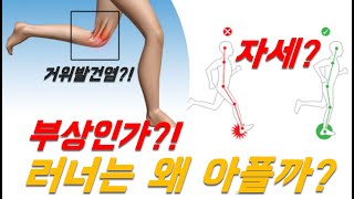 왜 러너들은 부상을 달고 사는가?