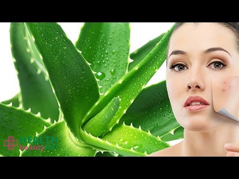 8 Secrets to Get Rid of Chicken Pox Scars Quickly! 8 Secrets to Get Rid of Chicken Pox Scars Quickly!