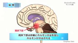 更年期障害／ミルメディカル　家庭の医学 動画版