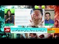 dark spots on skin causes and treatment essential tips by dr bilal shams bol news