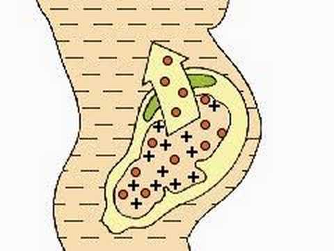 How the Body Works : The Rh Factor How the Body Works : The Rh Factor