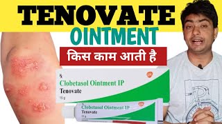 tenovate ointment | tenovate ointment uses in hindi | tenovate ointment uses | tenovate