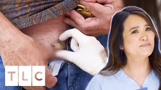 "It Was Smaller Than I Thought It Would Be" Bump On Man's Groin Area Is Removed | Dr. Pimple Popper