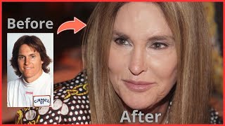 15 Shocking Male Stars’ Plastic Surgery Transformations! | Hollywood Then & Now