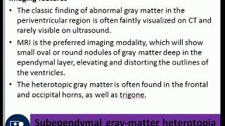 Subependymal gray-matter heterotopia (periventricular nodular heterotopia), febrile seizures