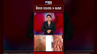 ଜାଣନ୍ତୁ ଆପଣ ଙ୍କ କିଡନୀ ଖରାପ ହୋଇଛି କି ନାହିଁ ? METRO TV ODISHA ||