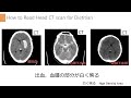 45①【栄養士が知りたい画像 初級編 _頭部ct】how to read head ct scan for dietitian