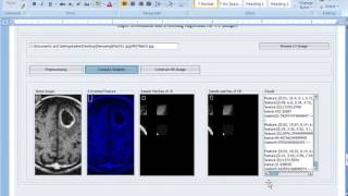 TSYS MEDICAL IMAGE PROCESSING PROJECT IN JAVA