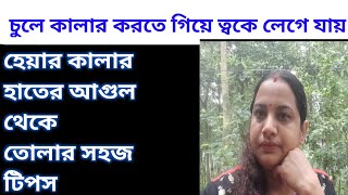 চুলে কালার করতে গেলেই ত্বকে লেগে গেলে কিভাবে তুলবেন/কলপ কার সমস্যা