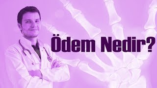 Ödem Nedir? | Op. Dr. Ziya Baran Soykan