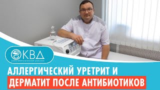 👉 Аллергический уретрит и дерматит после антибиотиков. Клинический случай №561