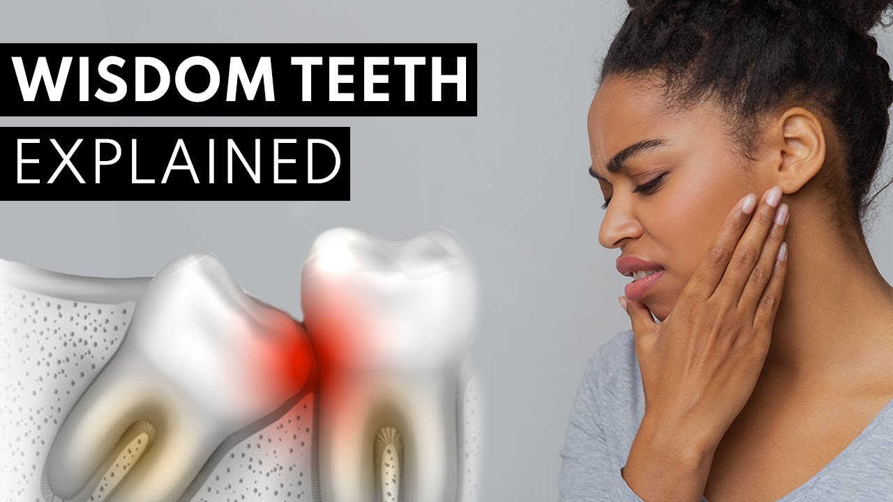 Wisdom Teeth Explained Pain Symptoms Extractions Youtube