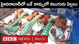 Hyderabad యువతికి ఒకే కాన్పులో నలుగురు పిల్లలు.. ప్రసవం రోజు ఏం జరిగిందంటే... | BBC Telugu