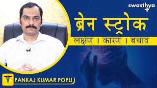 ब्रेन स्ट्रोक क्यों होता है? लक्षण, बचाव | Dr Pankaj Kumar Popli on Brain Stroke in Hindi