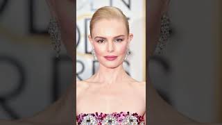 Five Celebrities Born with Defects#shortvideo#shorts#celebrities