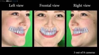 Model-Based Teeth Reconstruction (SIGGRAPH ASIA 2016)