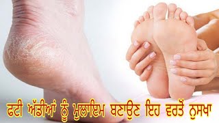 ਇਸ ਤਰੀਕੇ ਨਾਲ ਪਾਓ ਫਟੀ ਅੱਡੀਆਂ ਤੋਂ ਛੁਟਕਾਰਾ , cracked heels home made cream remedy