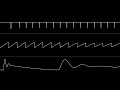 Orcan - “Diffusion” (C64) [Oscilloscope View]