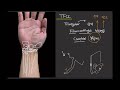 손목의 tfcc 삼각섬유연골복합체 를 다쳐서 아픈거라는데 이게 도대체 뭐죠