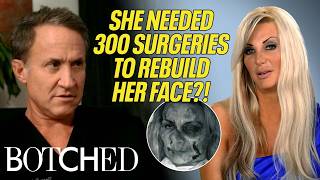 Sarah Spent $3 MILLION on 300 Surgeries to Repair Her Destroyed Face?! | Rejected By Botched | E!
