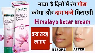 Himalaya Kesar Fairness Cream – Fairness Ka Jadoo? 😍