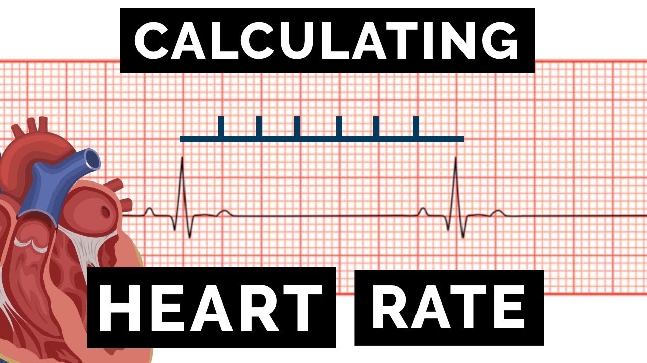 Ekg Heart Rate Scale How To Determine Heart Rate On Ecg Cerebro
