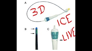 #3DICE #intracardiacecho  with view of valves | how to use ICE | Echocardiography