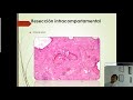 sesión anatomopatológica tumor mixofibroso lipoesclerosante