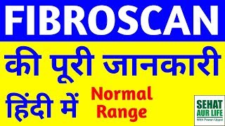 Fibroscan Of Liver In Hindi, Fibroscan Of Liver Normal Range, Liver Fibroscan Results, In Hindi