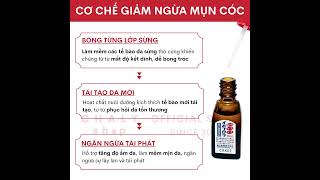 [Review] Thuốc trị mắt cá, mụn cóc, chai sần Ibokorori Nhật Bản | Shop Nhật Chaly