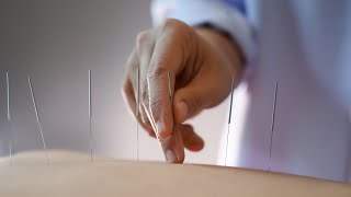 How Acupuncture Helps Relieve Pain | Traditional Chinese Medicine | TCM – Manhattan Physical Therapy