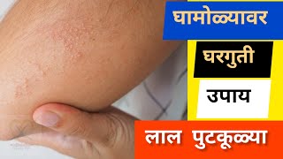 घामोळ्या वर घरगुती उपाय | Ghamolya vr Gharguti Upay | Heat Rashes In Marathi | HealthyTipsMarathi