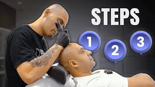 Step-by-Step SMP Procedure at Scalp Revival in NSW | What to Expect