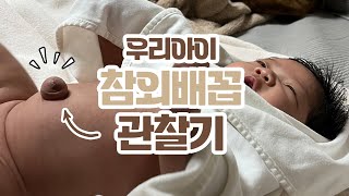 참외배꼽 I 탈장 I 50일간의 관찰기 I 쿠키월드